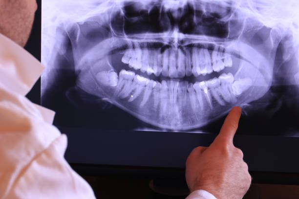 Best Broken or Chipped Tooth Repair in Old Bethpage, NY